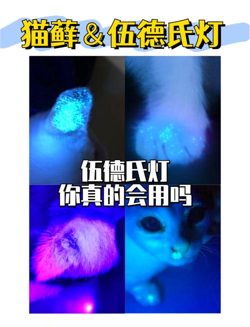 伍德灯检查的准不准